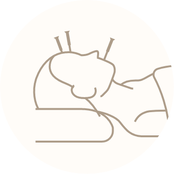 美容鍼のイメージイラスト